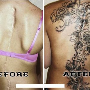 Amazing Scar-Covering Tattoos - Epic Cover Up