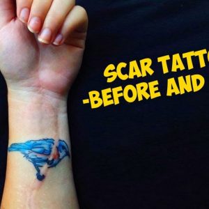 Amazing Scar Tattoos Before and After