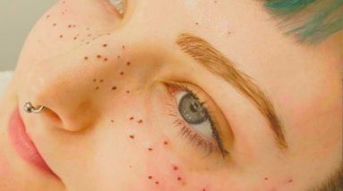 Are freckle tattoos the latest beauty trend?