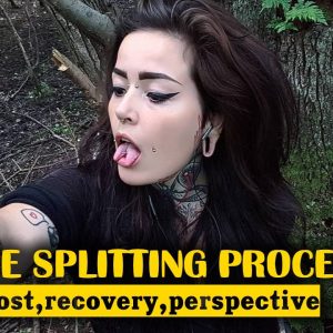 Tongue Splitting Procedure, Cost, Recovery, Perspective